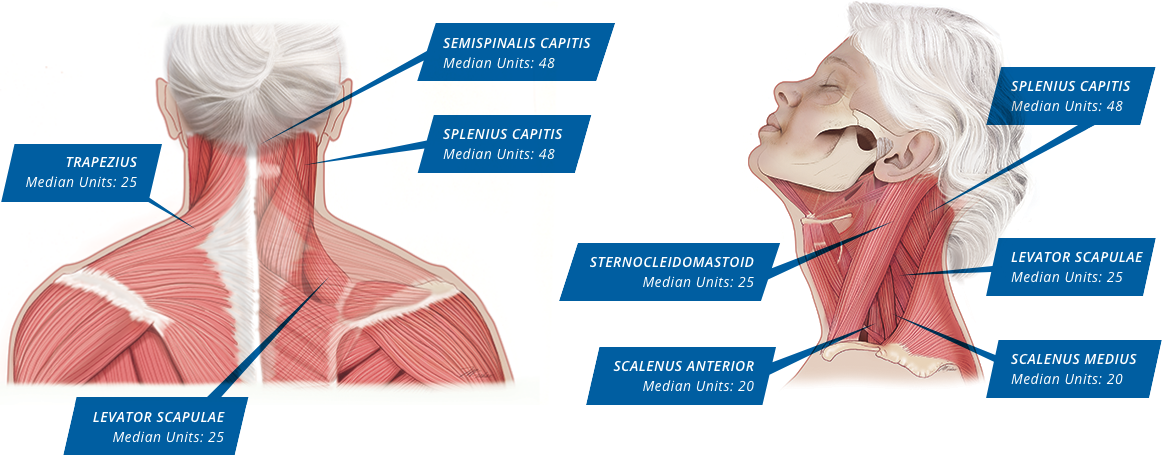 XEOMIN dosing and admin instructions for adults with cervical dystonia