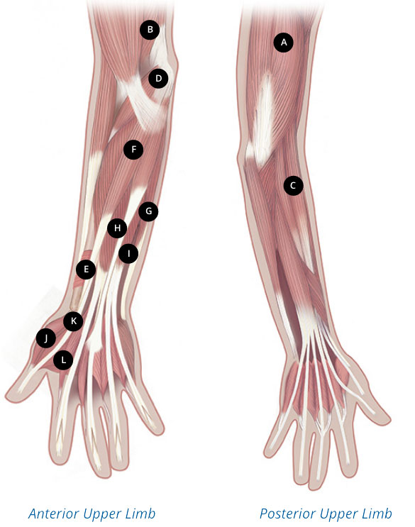 XEOMIN dosing and admin instructions for pediatric upper limb spasticity